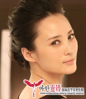 鼻翼缩小手术疼不疼? 鼻翼缩小手术疼不疼?
