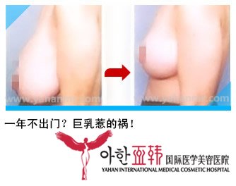 一年不出门?巨乳惹的祸!115 一年不出门?巨乳惹的祸!115