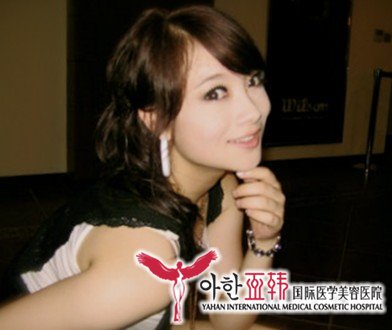 美白针你知多少?336 美白针你知多少?336