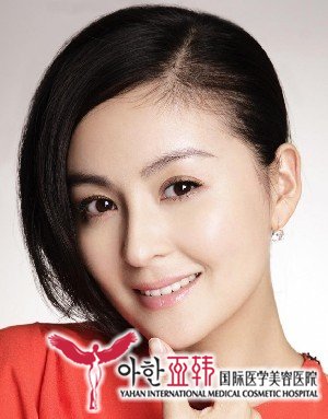 红血丝祛除后如何护理才能保持最佳效果?339 红血丝祛除后如何护理才能保持最佳效果?339
