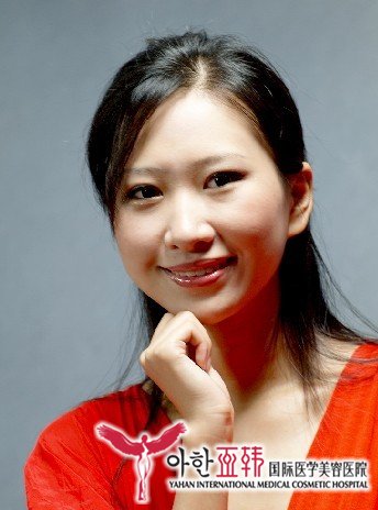 激光治疗鲜红斑痣还原自信好肌肤!657 激光治疗鲜红斑痣还原自信好肌肤!657