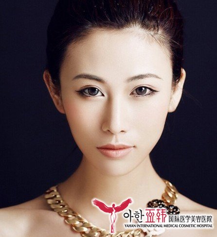 鼻头缩小手术有什么特点?075 鼻头缩小手术有什么特点?075