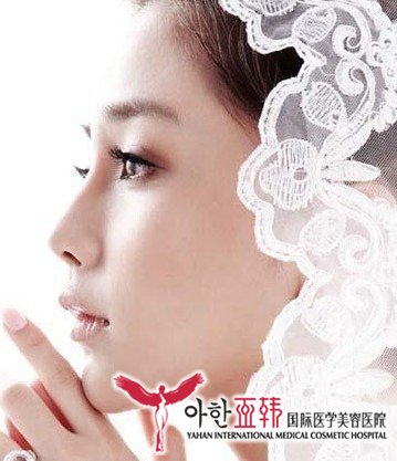 什么是鼻小柱成形?088 什么是鼻小柱成形?088