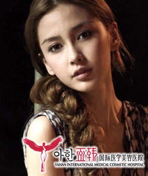 什么是鼻小柱延长术287 什么是鼻小柱延长术287