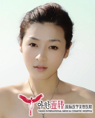 隆鼻手术可以改善鼻子过短的缺陷吗?742 隆鼻手术可以改善鼻子过短的缺陷吗?742