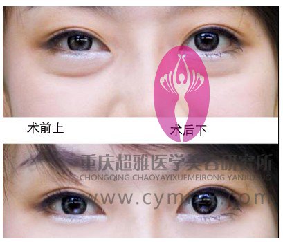 再也不见，眼袋564