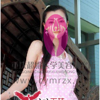 提眉术帮你解决眉部烦恼257 提眉术帮你解决眉部烦恼257