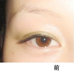 快睫睫毛增长液效果不错哟062 快睫睫毛增长液效果不错哟062