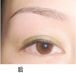 快睫睫毛增长液效果不错哟062 快睫睫毛增长液效果不错哟062