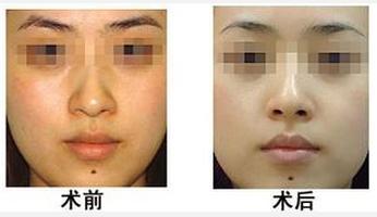 怎样快速美白嫩肤? 怎样快速美白嫩肤?