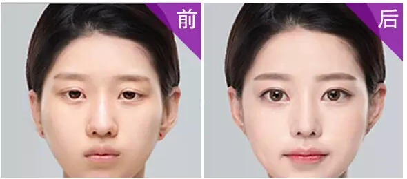 给你几个做双眼皮的理由289 给你几个做双眼皮的理由289
