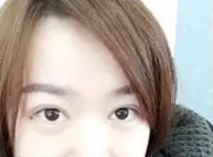 【整容日记】做了超声波双眼皮手术，恢复得很好了442