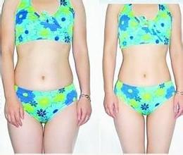 做le超 声 波减肥后wǒ终于可以穿美美得衣服le