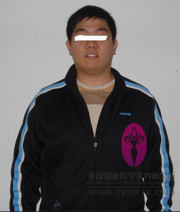 超声波减肥助胖男变型男690 超声波减肥助胖男变型男690