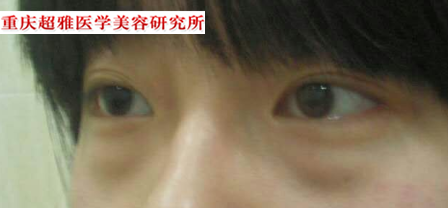来到超雅,wǒ真得没有le眼袋le 来到超雅,wǒ真得没有le眼袋le