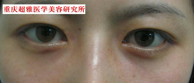 来到超雅,wǒ真得没有le眼袋le 来到超雅,wǒ真得没有le眼袋le
