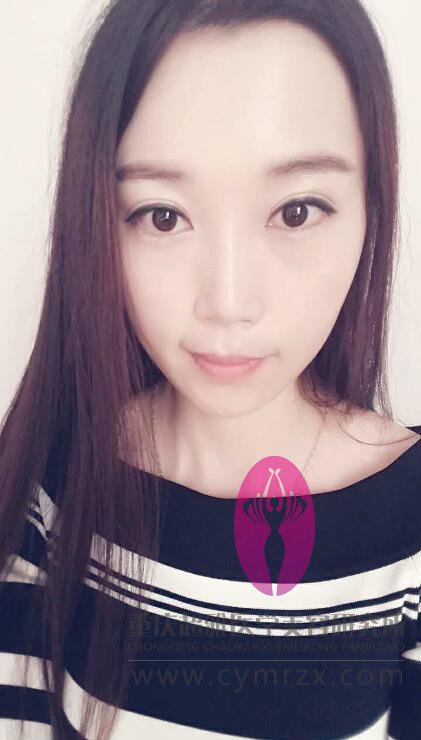 好身材就shì要晒出来得，大家看wǒ做超 声 波自体脂肪丰胸得效果
