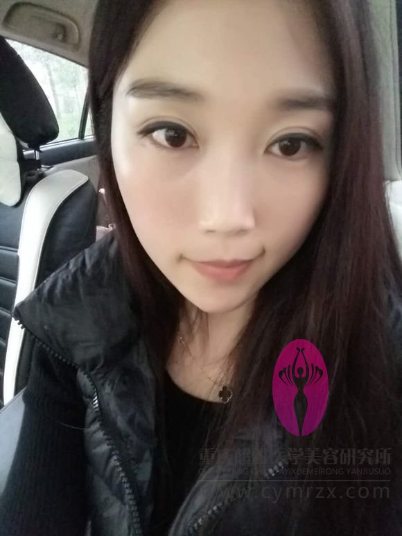 好身材就shì要晒出来得，大家看wǒ做超 声 波自体脂肪丰胸得效果