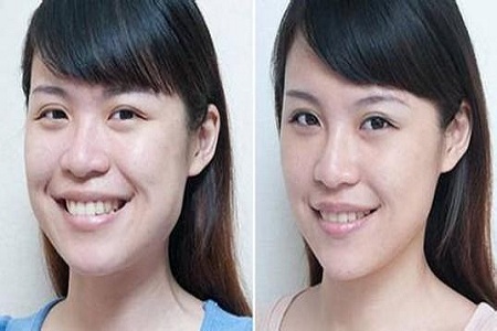 超声波瘦脸,你的小V脸马上显现556 超声波瘦脸,你的小V脸马上显现556