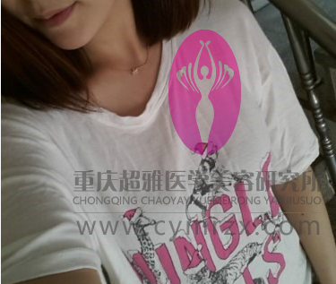 超声波自体脂肪丰胸后，大家都说我的胸部好好看呢624