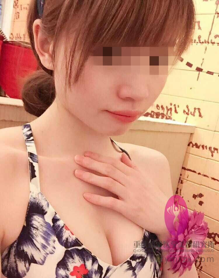 超声波自体脂肪丰胸后，大家都说我的胸部好好看呢624