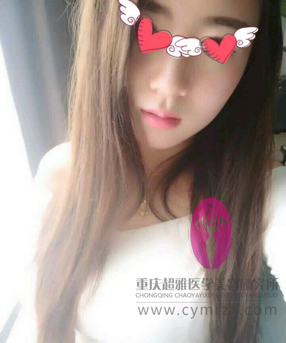 wǒshì重庆美眉，分享下在重庆超雅做超 声 波自体脂肪丰胸经历