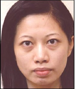 超声波去眼袋帮我解决了我最头疼的眼袋问题104 超声波去眼袋帮我解决了我最头疼的眼袋问题104