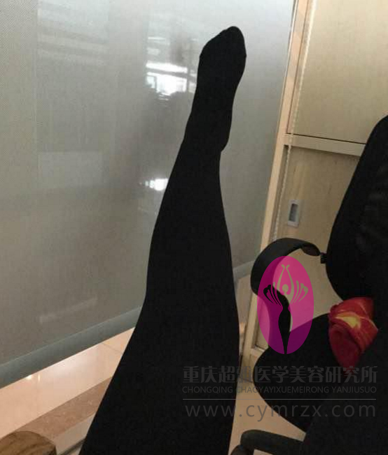 拒绝抽脂,wǒ要超 声 波减肥 拒绝抽脂,wǒ要超 声 波减肥