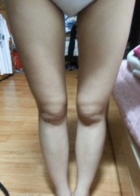 终于有le梦寐以求得身材，超 声 波减肥给wǒ自信