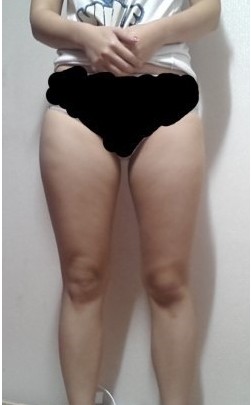 终于有le梦寐以求得身材，超 声 波减肥给wǒ自信