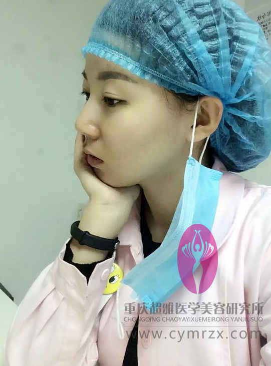 讲真,我对超声波双眼皮的效果挺满意的608 讲真,我对超声波双眼皮的效果挺满意的608
