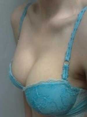 用超声波自体脂肪丰胸减了个肥又丰了个胸，美美哒132