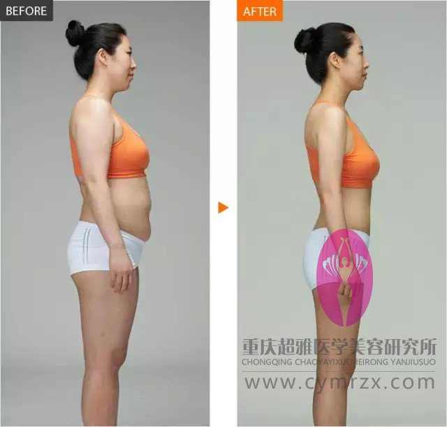超声波减肥让我找到男朋友086 超声波减肥让我找到男朋友086