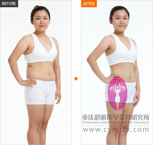 超 声 波减肥让wǒ瘦瘦瘦 超 声 波减肥让wǒ瘦瘦瘦