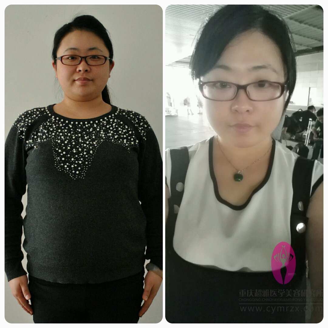 超 声 波减肥让wǒ体重下百le 超 声 波减肥让wǒ体重下百le