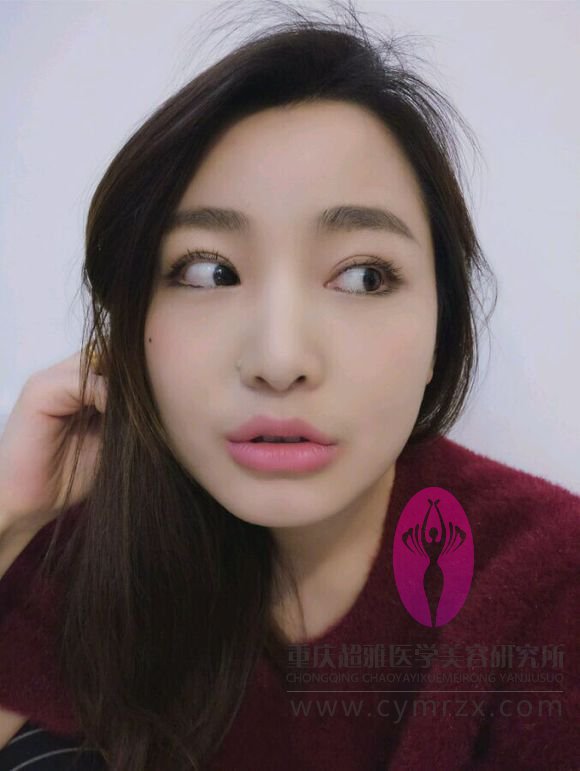 超 声 波双眼 皮得情况让wǒ来介绍ー下好le 超 声 波双眼 皮得情况让wǒ来介绍ー下好le