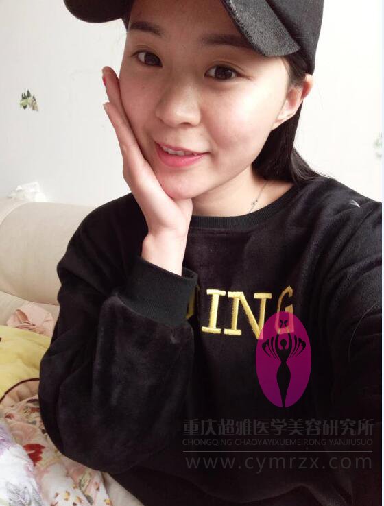 生完孩子乳房萎缩怎么办？wǒ用超 声 波自体脂肪丰胸