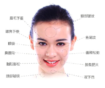 因为双眼 皮wǒ变le