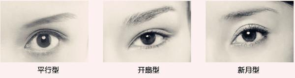 新尝试的双眼皮560 新尝试的双眼皮560