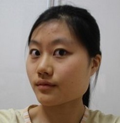 鼓足勇气做le超 声 波瘦脸,效果很好! 鼓足勇气做le超 声 波瘦脸,效果很好!