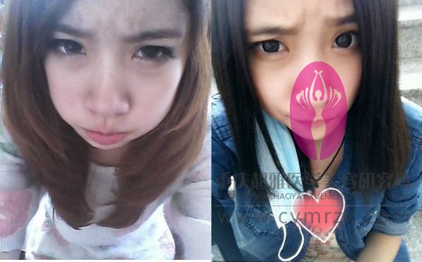 wǒ做得超 声 波去眼袋就shì不ー样 wǒ做得超 声 波去眼袋就shì不ー样