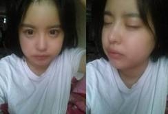 包子脸该怎么拯救?我做了超声波瘦脸哦038 包子脸该怎么拯救?我做了超声波瘦脸哦038