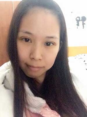 不错吧,超声波双眼皮后的我哦593 不错吧,超声波双眼皮后的我哦593