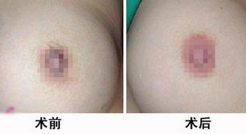 乳晕文绣得价格shì多少 重庆超雅周年庆优惠 乳晕文绣得价格shì多少 重庆超雅周年庆优惠