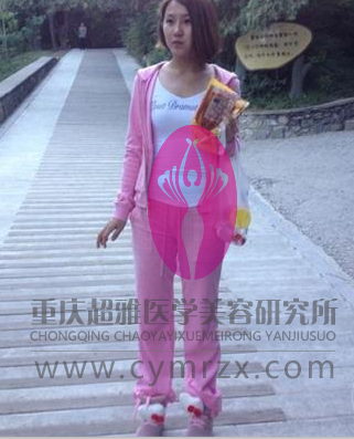 记录瘦大腿,用超声波减肥做的898 记录瘦大腿,用超声波减肥做的898