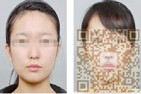 为您讲述瘦脸针得价格 为您讲述瘦脸针得价格