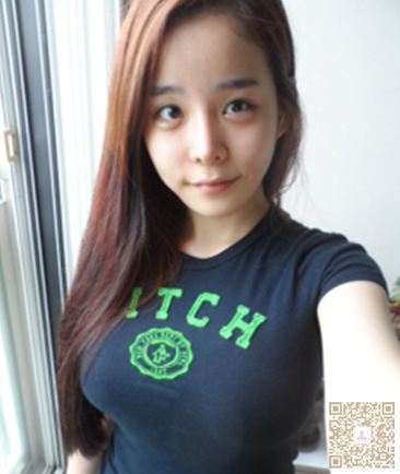 超声波自体脂肪丰胸的变化很大哦,记录贴858 超声波自体脂肪丰胸的变化很大哦,记录贴858