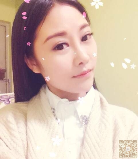 记录我在重庆超雅做鼻部整形后的效果359 记录我在重庆超雅做鼻部整形后的效果359