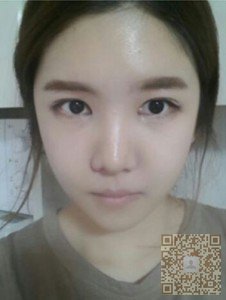 超声波瘦双下巴,也许你也需要!001 超声波瘦双下巴,也许你也需要!001