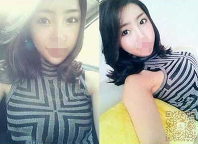 我和朋友都做了超声波瘦脸,小V脸果然很美146 我和朋友都做了超声波瘦脸,小V脸果然很美146